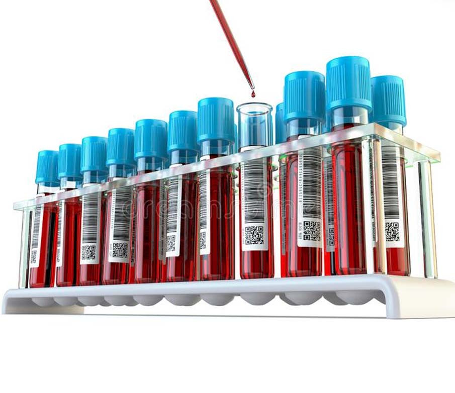 Análises Bioquímicas do Sangue