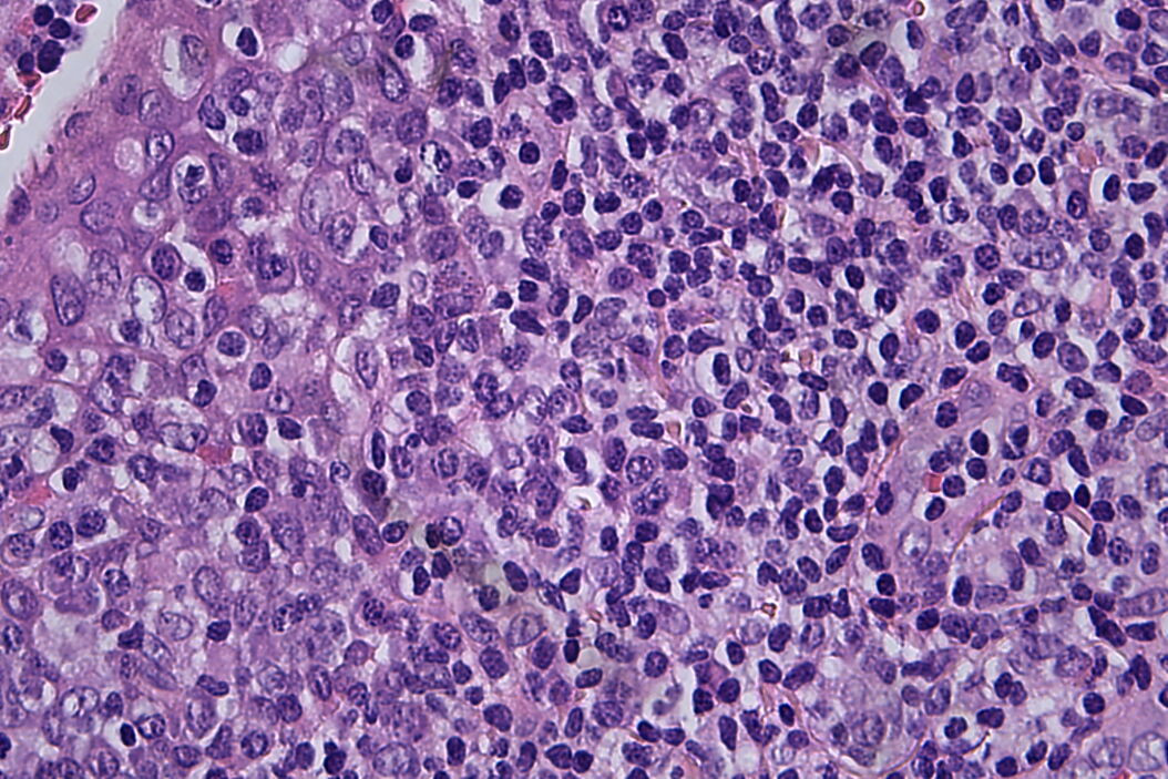 Fatores a Considerar ao Escolher uma Câmera para Microscopia