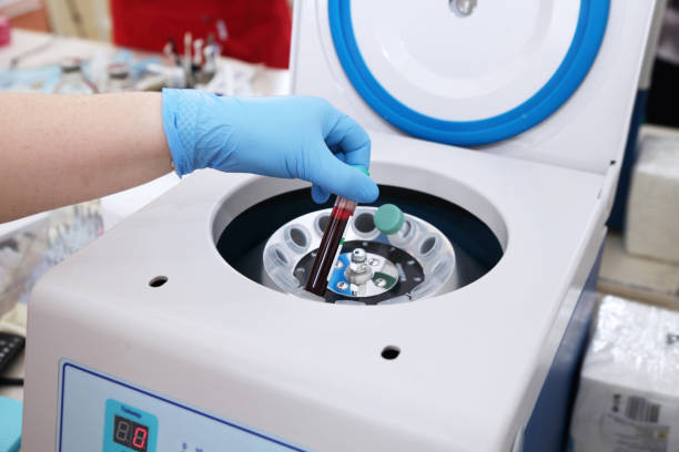 Guia de Amostra de Sangue Centrifugado