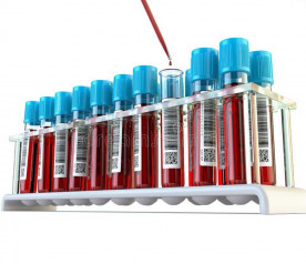 Análises Bioquímicas do Sangue