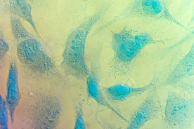 O que você deve saber sobre microscopia de luz polarizadora