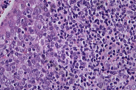 Fatores a Considerar ao Escolher uma Câmera para Microscopia