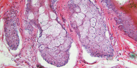 Redefinindo a microscopia infravermelha usando lasers de cascata quântica